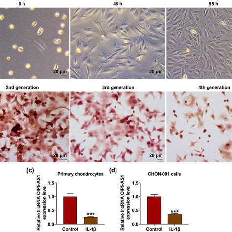 Identification Of Primary Chondrocytes And Downregulation Of Oip As