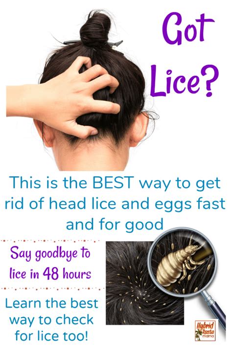 Coconut Oil For Lice Natural Lice Remedies Home Lice Remedies Hair Lice