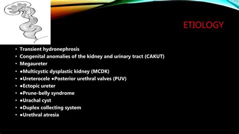 Fetal Hydronephrosis Ppt