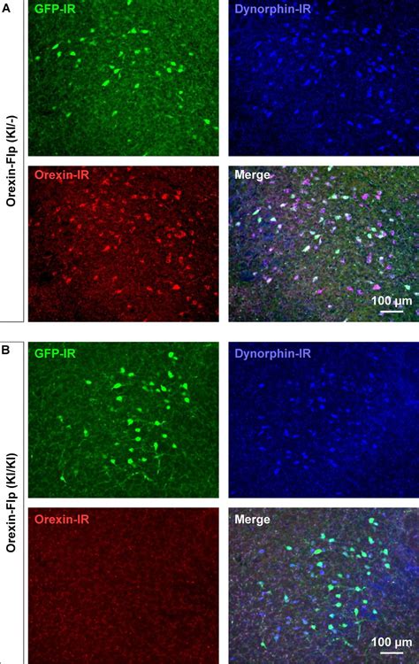 Dissociating Orexin Dependent And Independent Functions Of Orexin