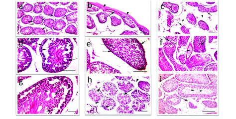 Photomicrographs Of Testicular Tissues Hande A From Control Group A