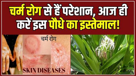 Health Tips चर्म रोग का रामबाण इलाज है ये औषधीय पौधा गंभीर बीमारियां होती है जड़ से खत्म