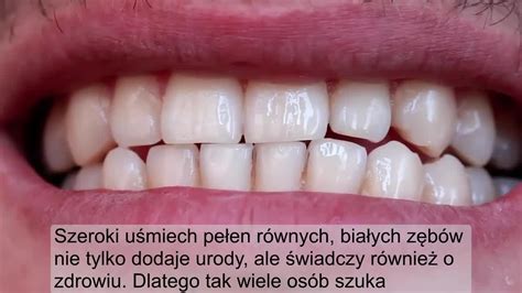 Naturalne domowe wybielanie zębów w domu w 5 minut CDA