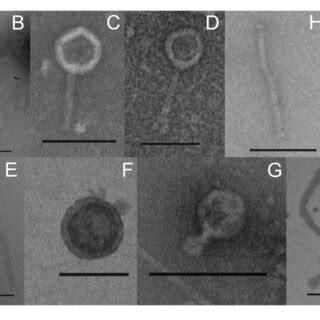 Transmission Electronic Micrographs Of Vlps Obtained From The