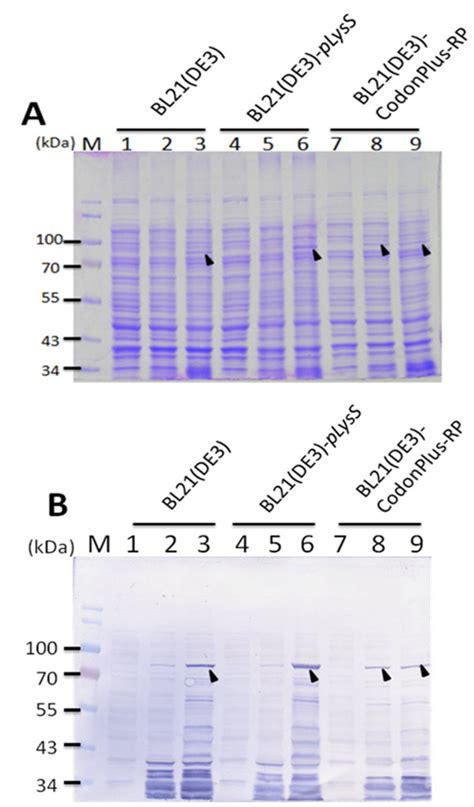 Expression Of Recombinant Gst Vp1 Protein In Three Different E Coli