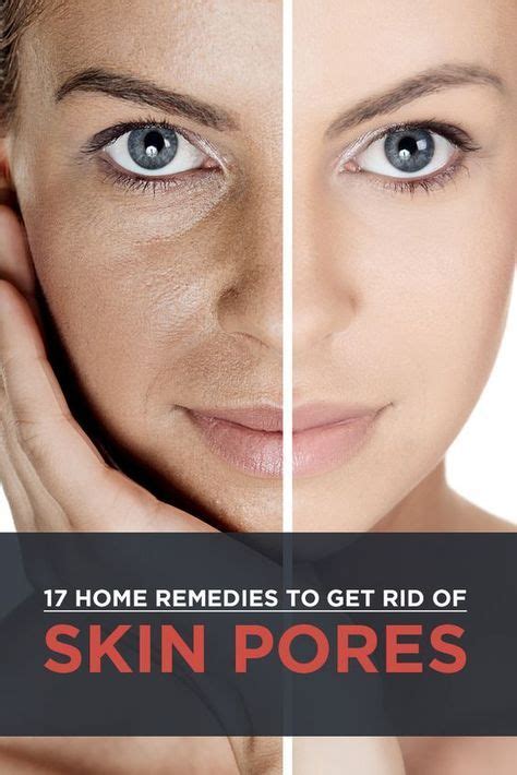 20 Home Remedies To Get Rid Of Open Pores On Skin Artofit