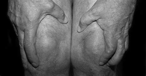 What Is Osteoarthritis And Why Is It So Hard To Diagnose The New