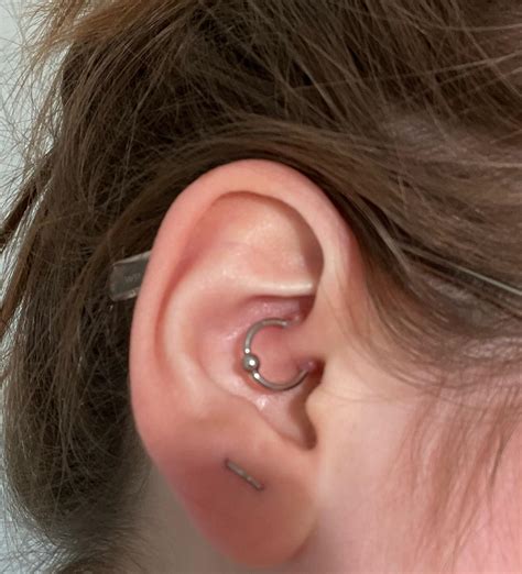 Huge Daith Irritation Bump Out Of Nowhere R Piercing