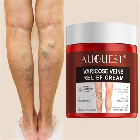 G Varicose Veins Relief Cream Vasculitis Phlebitis Spider Pain Relief