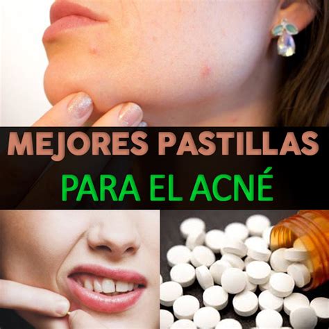 Las Mejores Pastillas Para Quitar El Acn La Gu A De Las Vitaminas