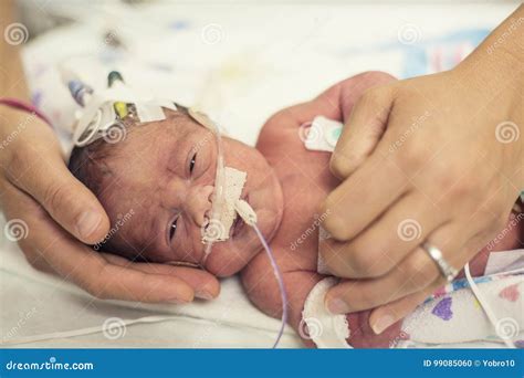 Newborn Premature Baby In The NICU Intensive Care Stock Photo Image