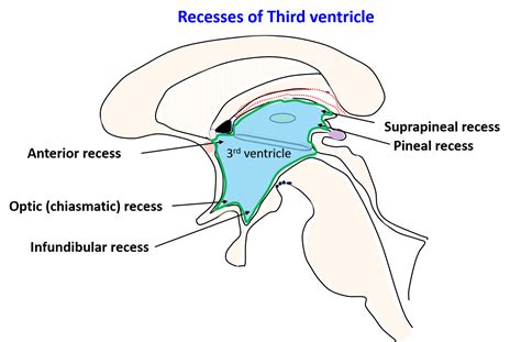 Third Ventricle – Anatomy QA