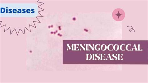 Meningococcal Disease: Causes, Transmission, Risk Factors, Symptoms ...