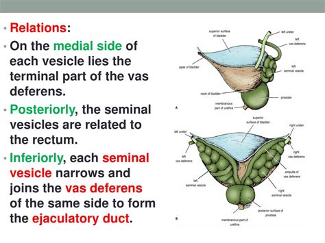 PPT Prostate Seminal Vesicle And Ejaculatory Duct PowerPoint