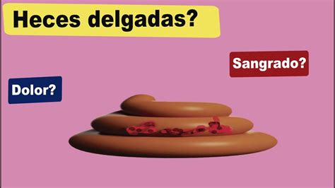 Estenosis Anal Heces Delgadas Dolor Al Evacuar Sangre En Heces