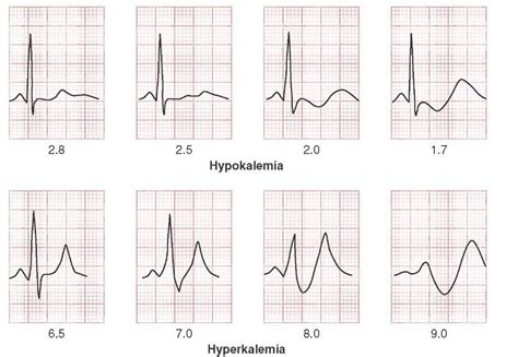 life in the fast lane ecg - Jackqueline Capps