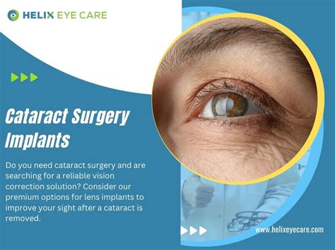 Cataract Surgery Implants Helix Eye Care Medium