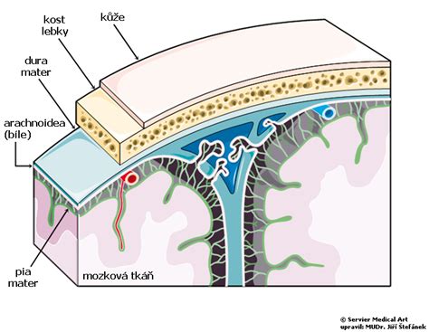 Subarachnoid Ln Krv Cen Medic Na Nemoci Studium Na Lf Uk