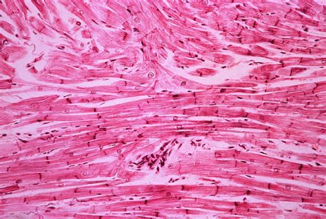 Cardiac Muscle 1 By Science Photo Library