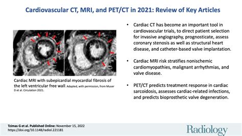 Cardiovascular Ct Mri And Petct In 2021 Review Of Key Articles