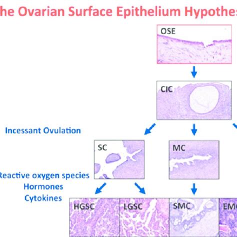 Schematic Representation Of The Ovarian Surface Epithelium Hypothesis