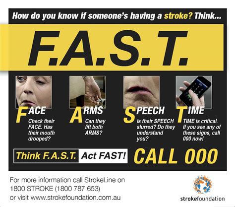 How To Recognise A Stroke And What You Should Know About Their Treatment