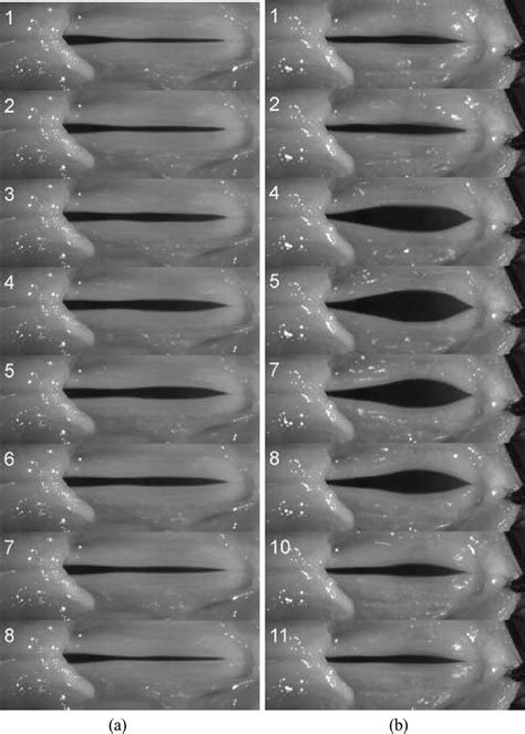 High-speed image sequences of glottal area throughout a single glottal ...