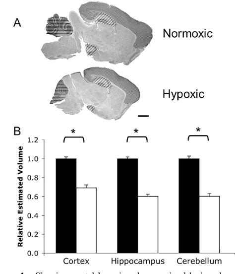 Figure 1 From Sex Differences In A Hypoxia Model Of Preterm Brain