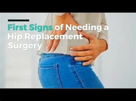 What Are The First Signs Of Needing A Hip Replacement Youtube