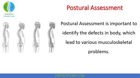 Postural Assessment Orthofixar 2023 52 Off