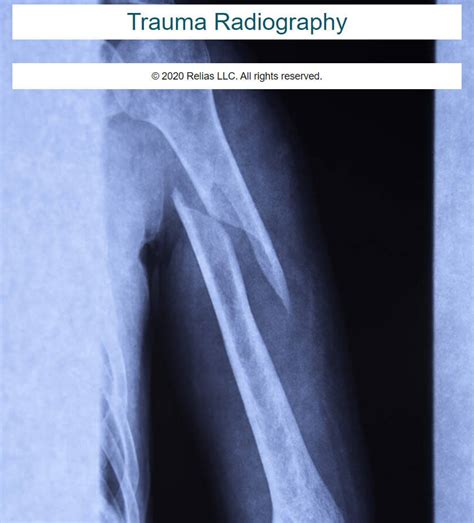 Trauma Radiography Relias Academy