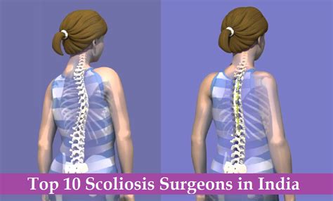 Top 10 Scoliosis Surgeons In India Best Scoliosis Doctors In India