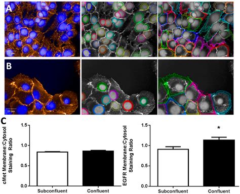IJMS | Free Full-Text | EGF Potentiation of VEGF Production Is Cell