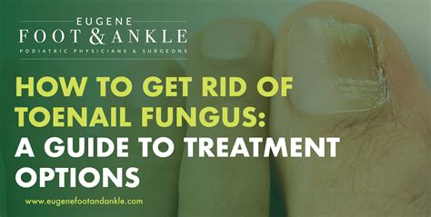 How To Get Rid Of Toenail Fungus Eugene Foot And Ankle