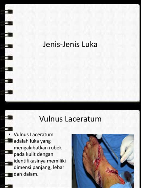 Jenis Jenis Luka Pdf