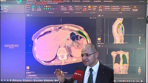 Prostat kanserinin tedavisinde yapay zeka başarısı Video Haberleri