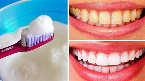 10 métodos para Clarear os dentes em casa