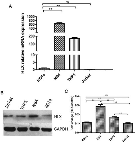 HLX Expression In AML Cell Lines A Comparison Of HLX Gene Expression