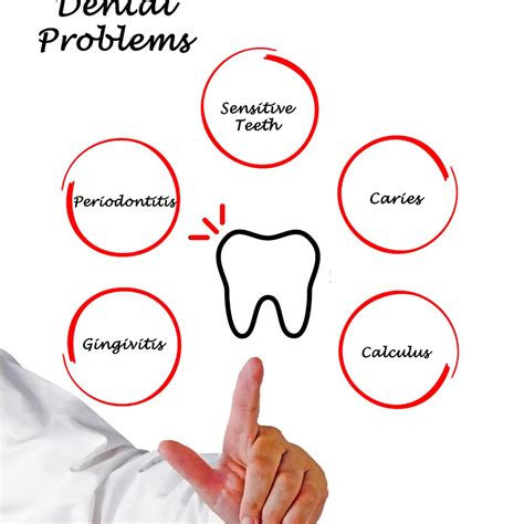 10 Common Dental Problems And How To Avoid Them