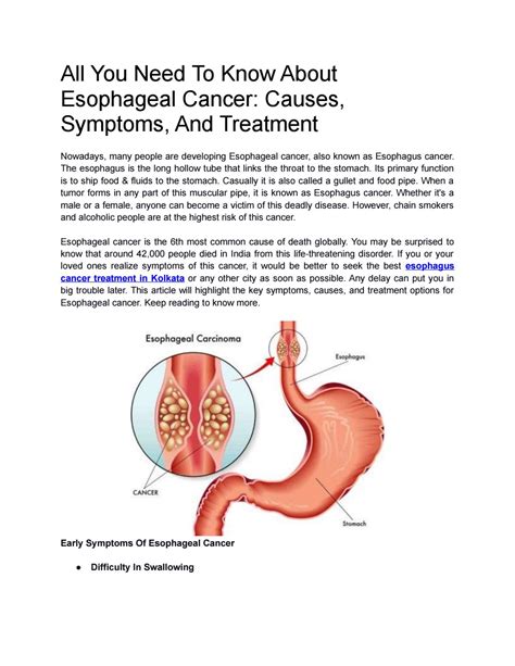 All You Need To Know About Esophageal Cancer Causes Symptoms And Treatment By Purnendu