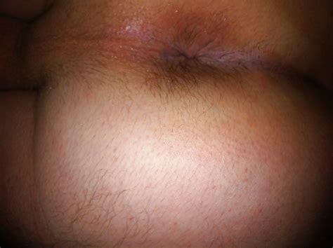 Cumshot Ass Cock Porn Pictures XXX Photos Sex Images PICTOA