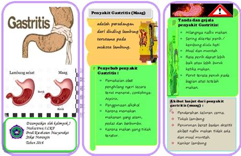 Ani Romaningsih Leaflet Gastritis Atau Maag