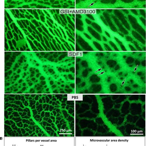 Effects Of Notch Inhibition On Intussusceptive Angiogenesis In The