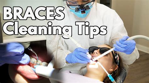 Cleaning Braces Tips Tricks For Dental Hygienists Youtube