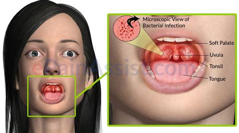 Strep Throat Virus Microscopic