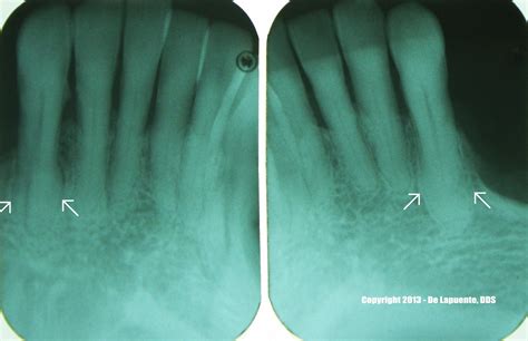 Diagnosing Oral And Maxillofacial Pathologies In My Residency