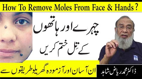 How To Remove Black And Brown Moles Naturally Chehre Ke Kale Til