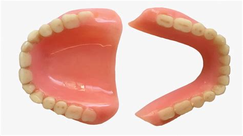 Denture Sore Mouth Tiew Dental Clinic Malaysia