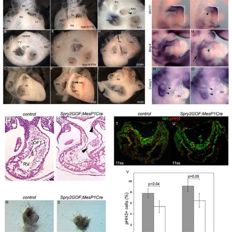 Antagonism Of FGF Signaling By Overexpression Of Spry2 Disrupts OFT