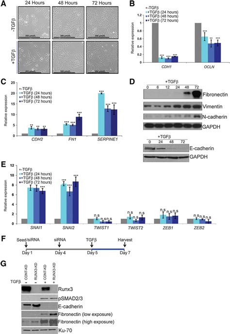 Characterization Of TGFb Dependent EMT In NSCLC Cells A A549 Cells